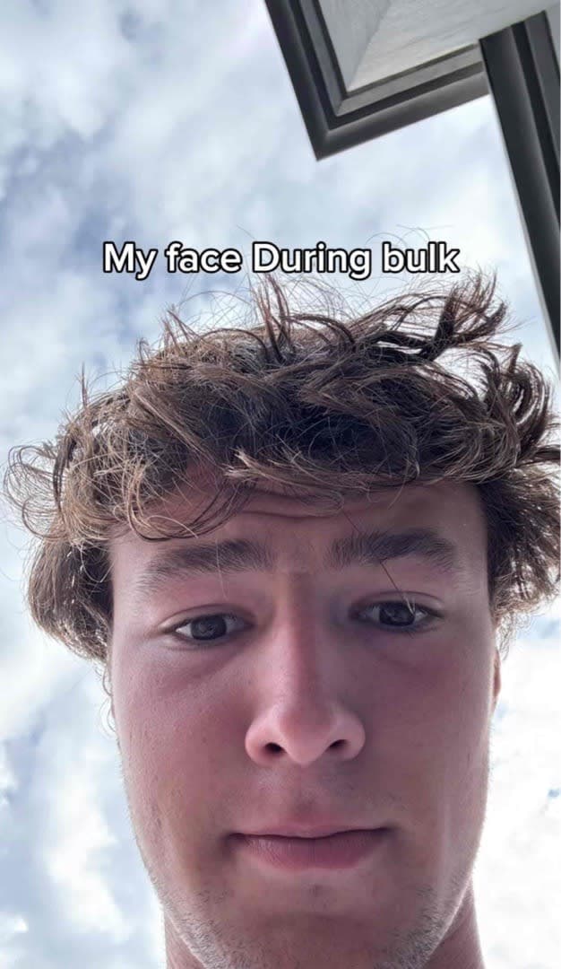 Why your face swells when you bulk